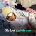 Israeli police cleared of any wrongdoing in shooting and blinding of Palestinian boy