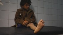 Huérfano y mutilado con 8 años, una de las vidas rotas por la guerra en Yemen