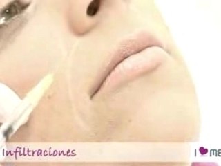 Tratamientos Faciales