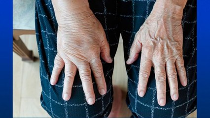 bd-causas-de-retencion-de-liquido-tobillos-pies-y-manos-111220