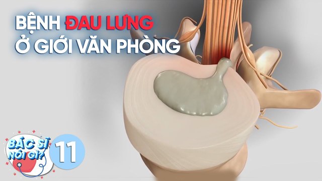 Bác Sĩ Nói Gì | Tập 11: Tìm hiểu về bệnh đau lưng hay gặp ở giới văn phòng và cách phòng tránh