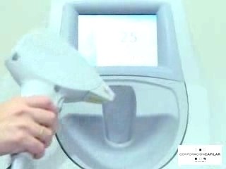 Depilación Láser Tipos