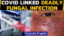 Rare Fungal infection triggered by Covid-19 | All you should know | Oneindia News