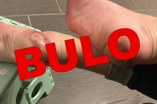 La historia de la foto que originó un bulo antivacunas