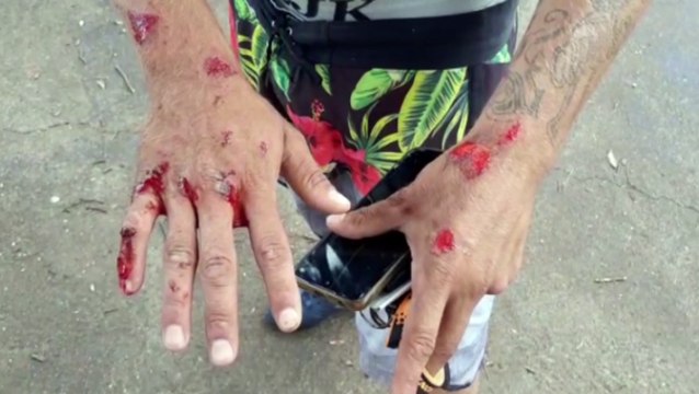 Motociclista fica ferido em acidente na Rua Paraná