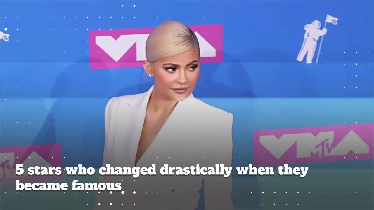 5 Stars Who Changed Drastically When They Became Famous