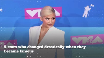 5 Stars Who Changed Drastically When They Became Famous