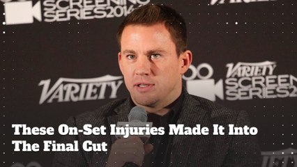 These On-Set Injuries Made It Into The Final Cut