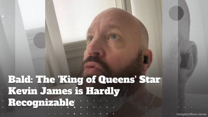 Bald: 'King of Queens' Star Kevin James is Hardly Recognizable!
