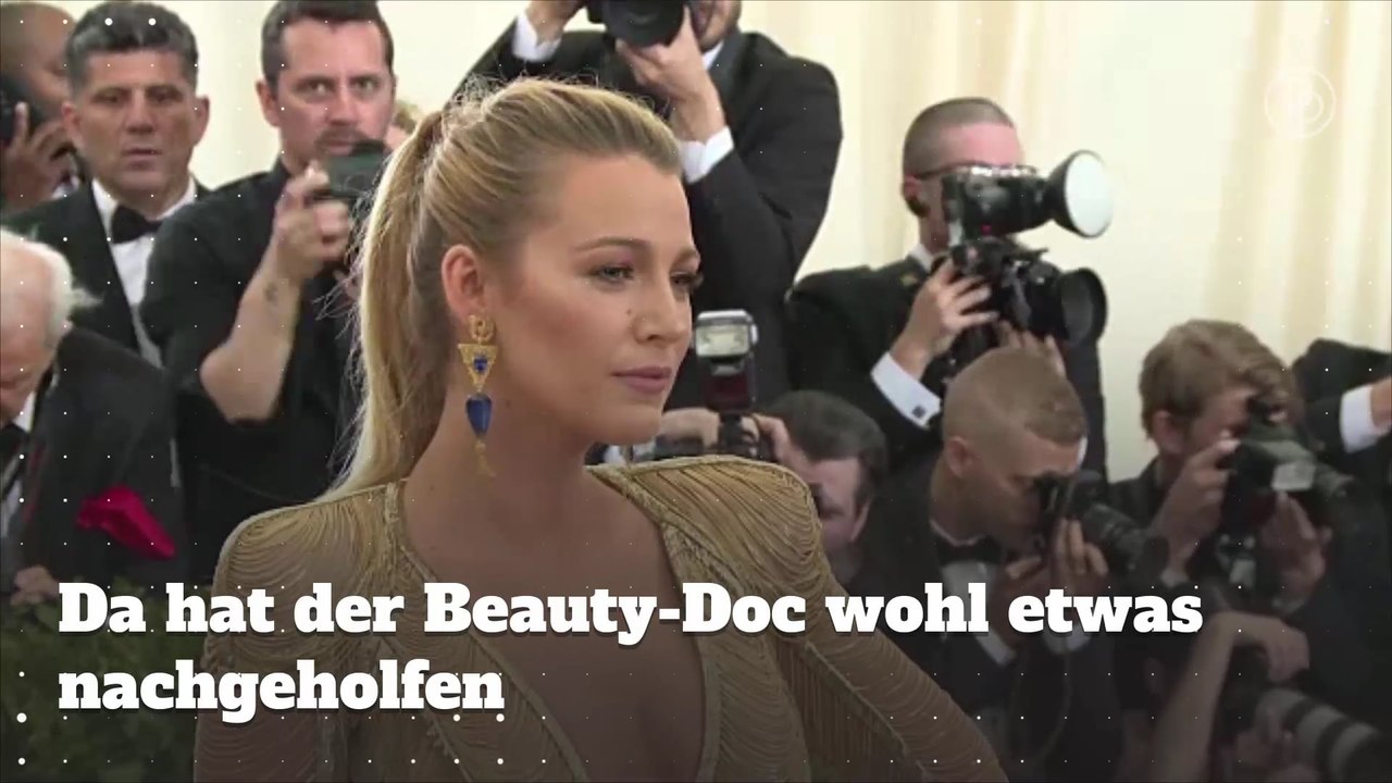 Stars, die eine Nasen-OP hatten