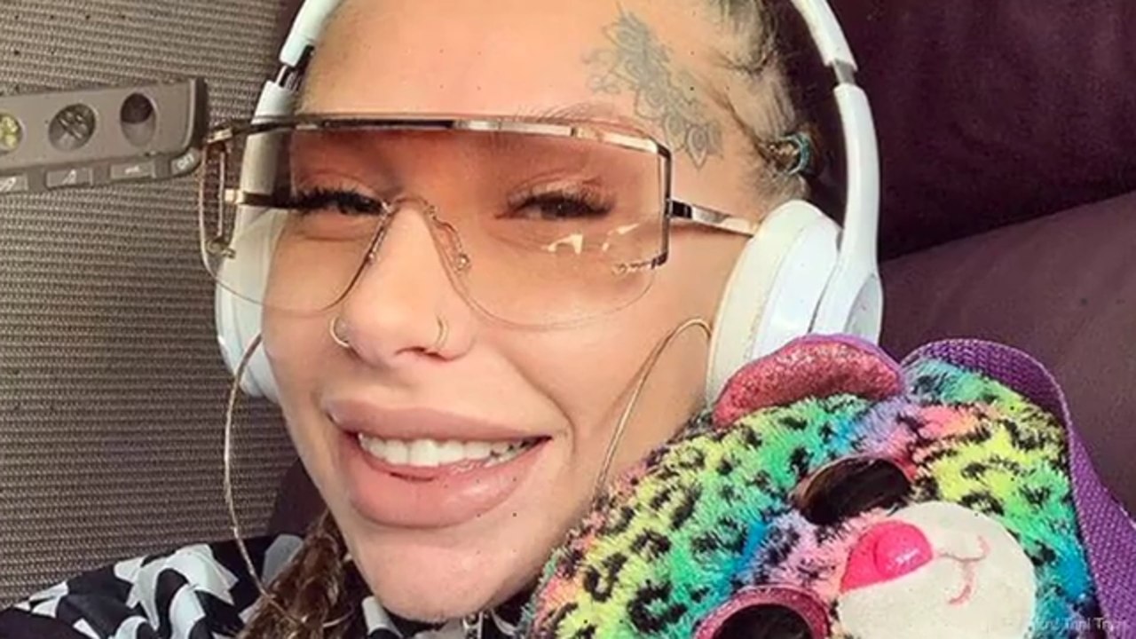 Toni Komljens Lippen: Das hat die Dschungelkandidatin machen lassen