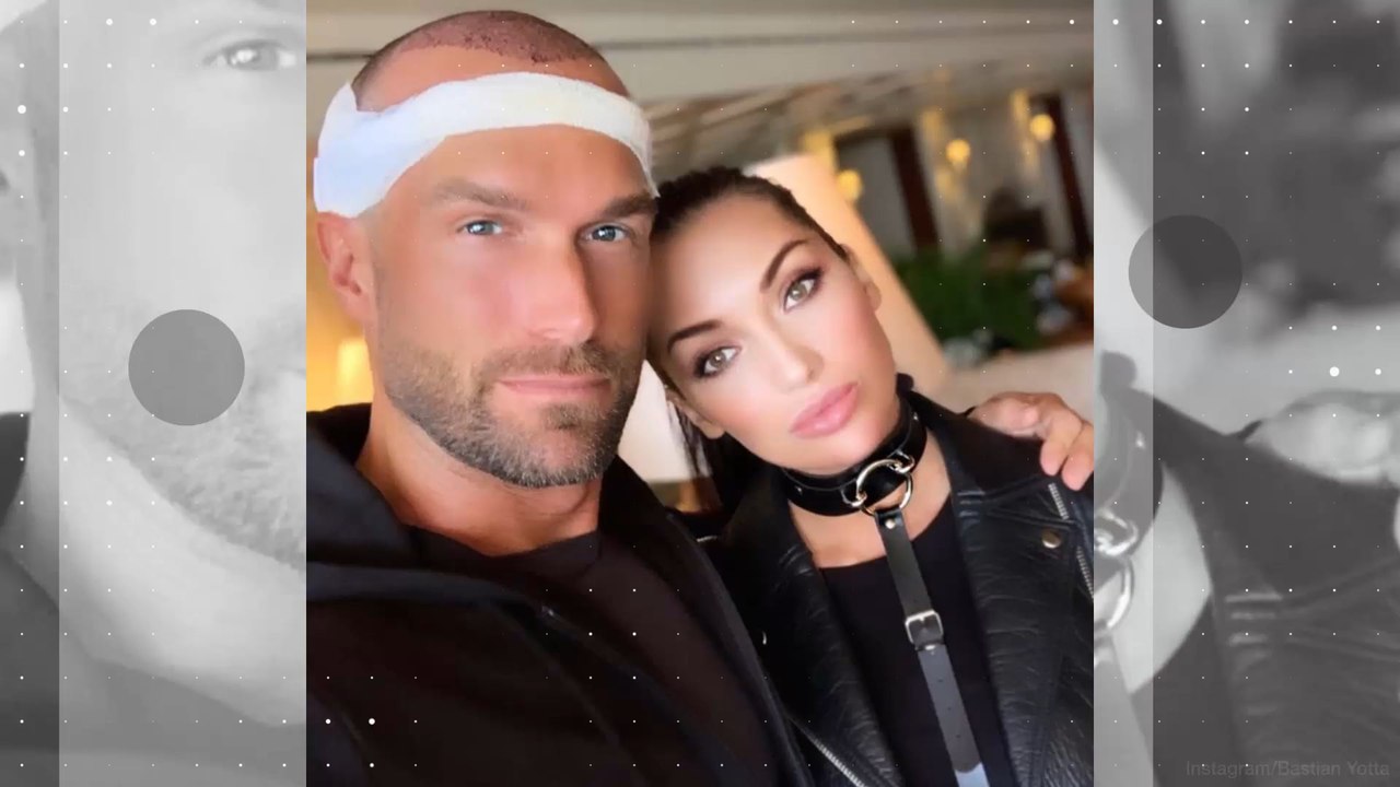 Bastian Yotta: Haartransplantation nach dem Dschungelcamp