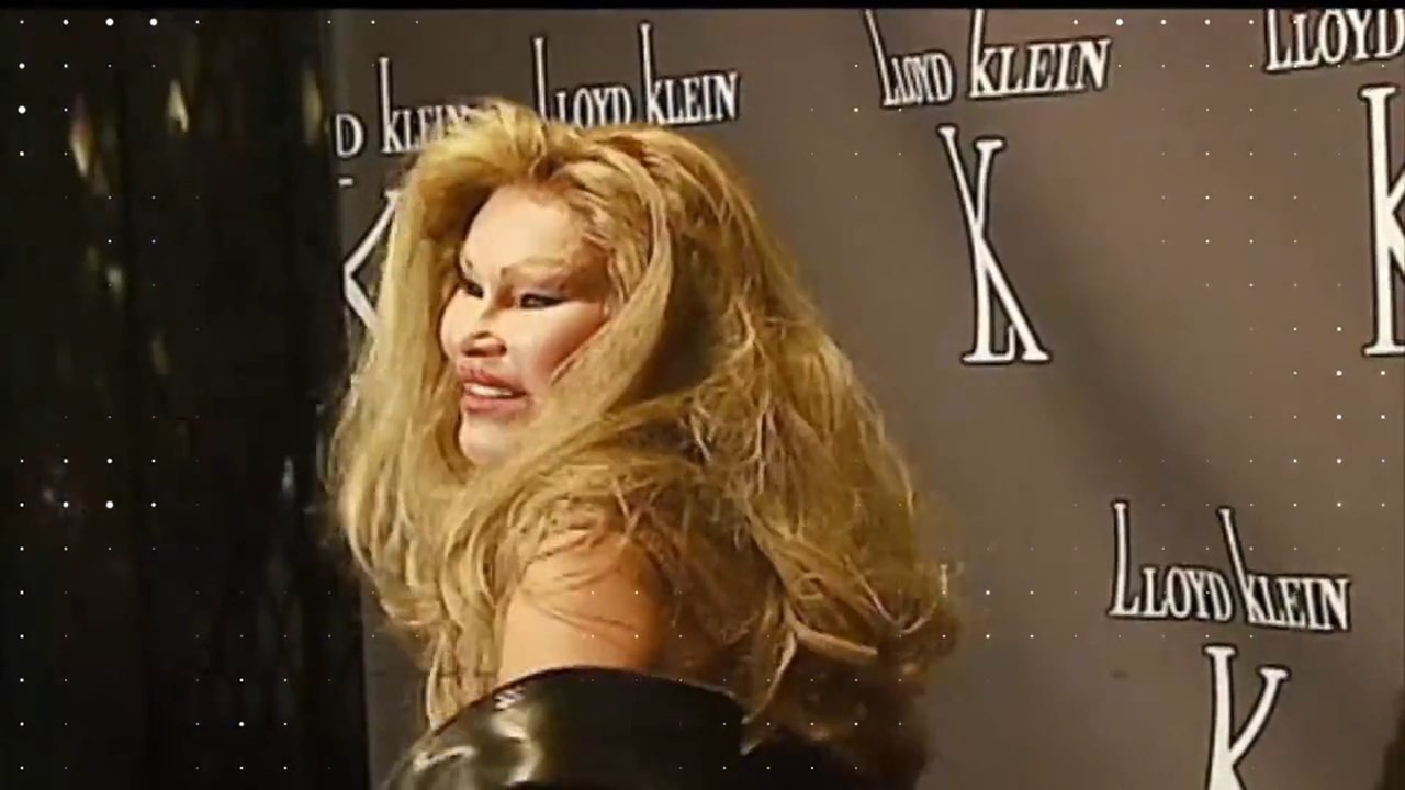 Jocelyn Wildenstein: Das sagt sie selbst zu ihrem Katzen-Gesicht