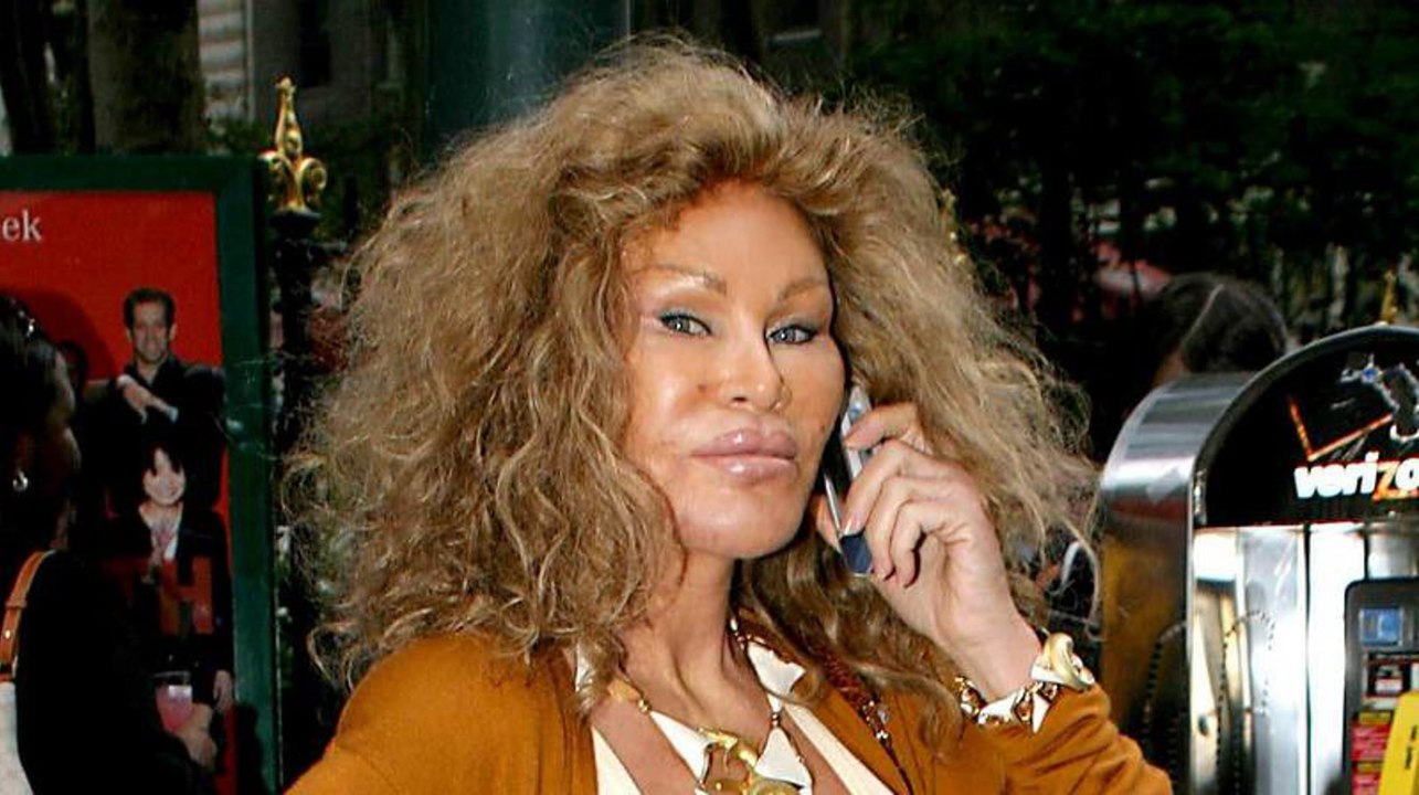 Katzenfrau Jocelyn Wildenstein: So sah sie mit braunen Haaren aus