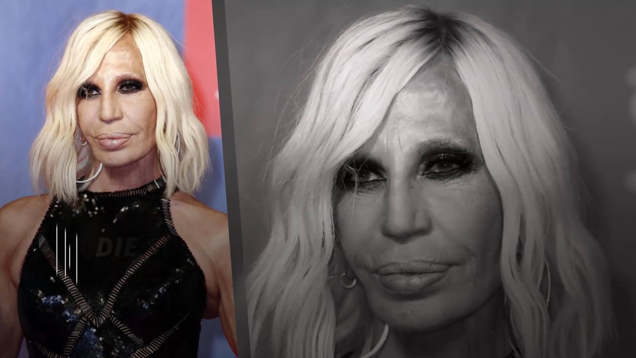 Die schlimmsten Botox-Gesichter