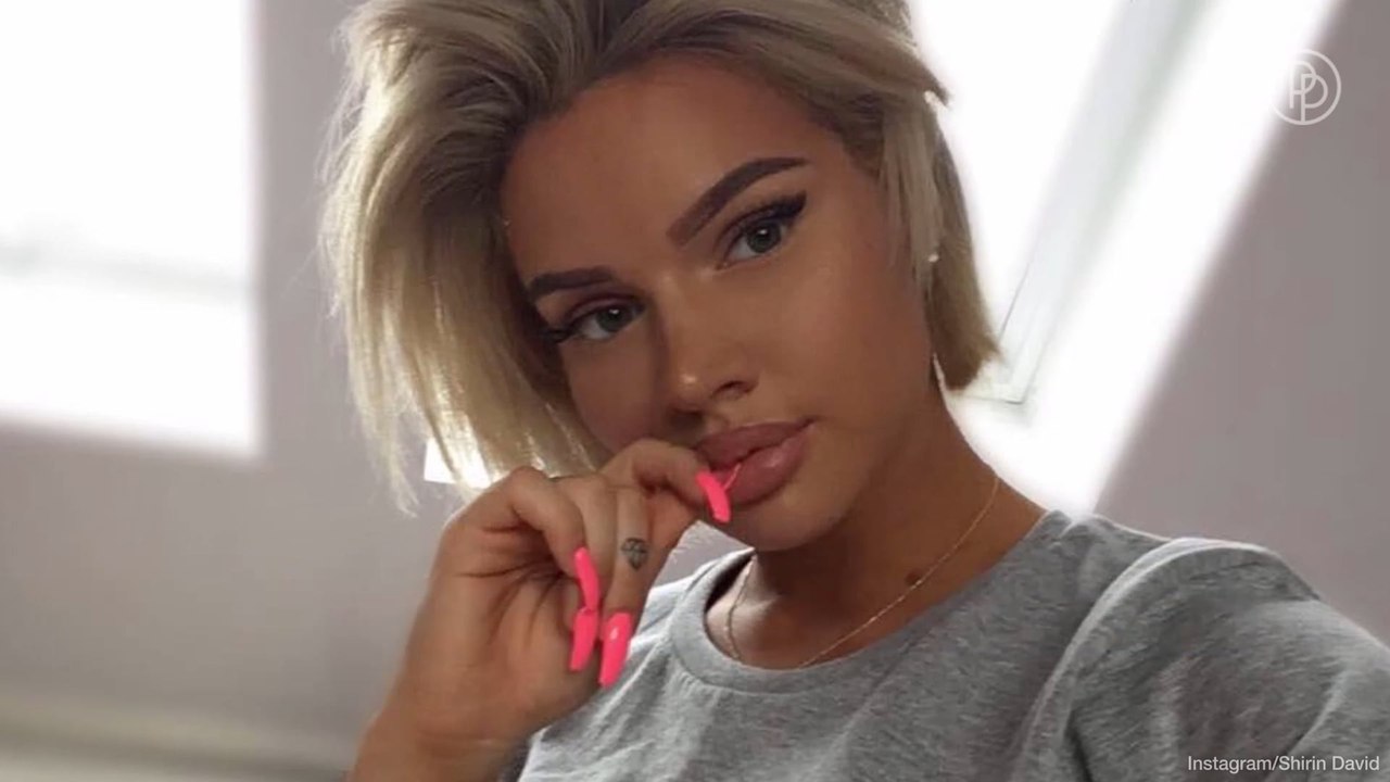 Shirin David verrät, ob sie Beauty-OPs hatte