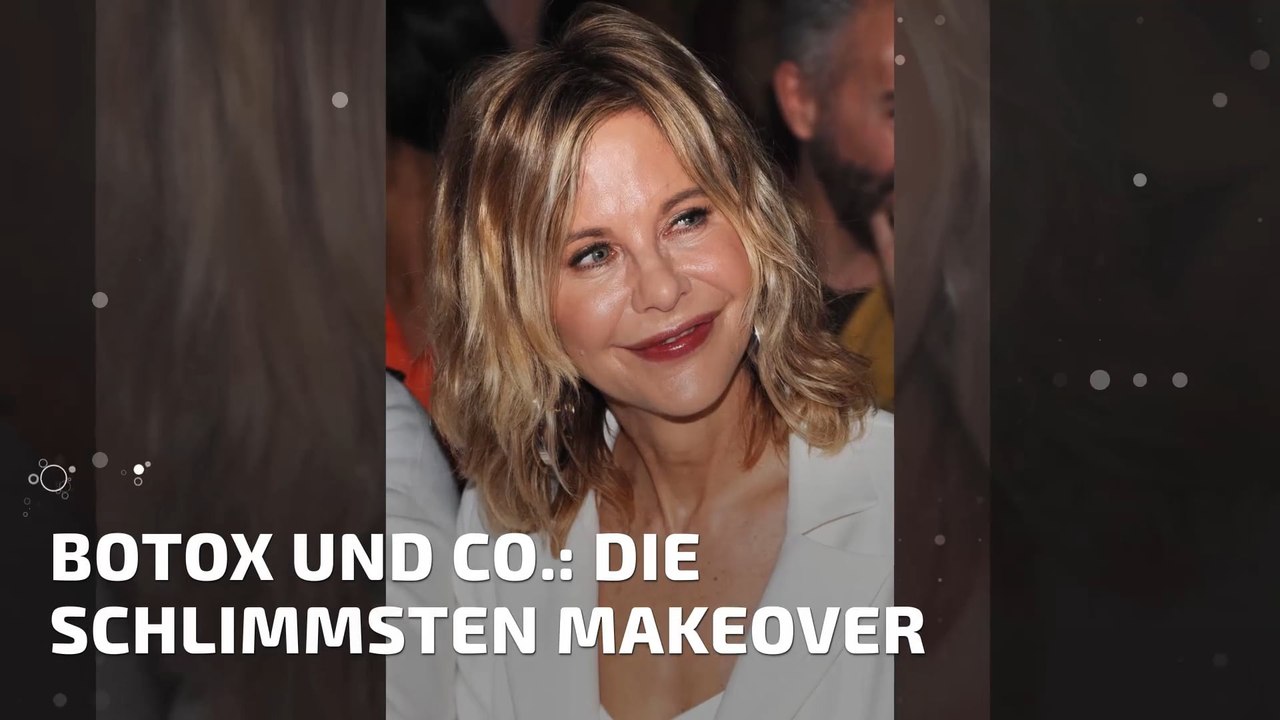 Botox Stars: Die schlimmsten Makeover