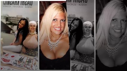 Stars vor den Beauty-OPs: Erkennt ihr, wer das ist?