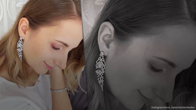 „Bauer sucht Frau“-Anna wehrt sich gegen Nasen-Lästereien