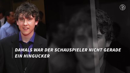 Stars, die sich in Schönheiten verwandelt haben