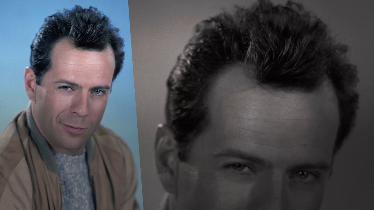 Haare oder Glatze - Was sieht bei diesen Stars besser aus?