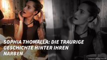 Sophia Thomalla: Die traurige Geschichte hinter ihren Narben