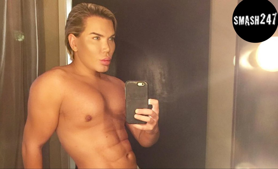 „Real Life Ken“ Rodrigo Alves: Zehnte OP an der Nase, doch sie könnte nun abfallen!