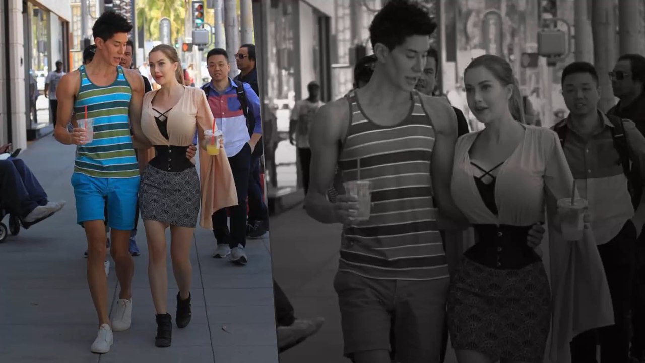 Rippen-Entfernung, um wie eine Puppe auszusehen