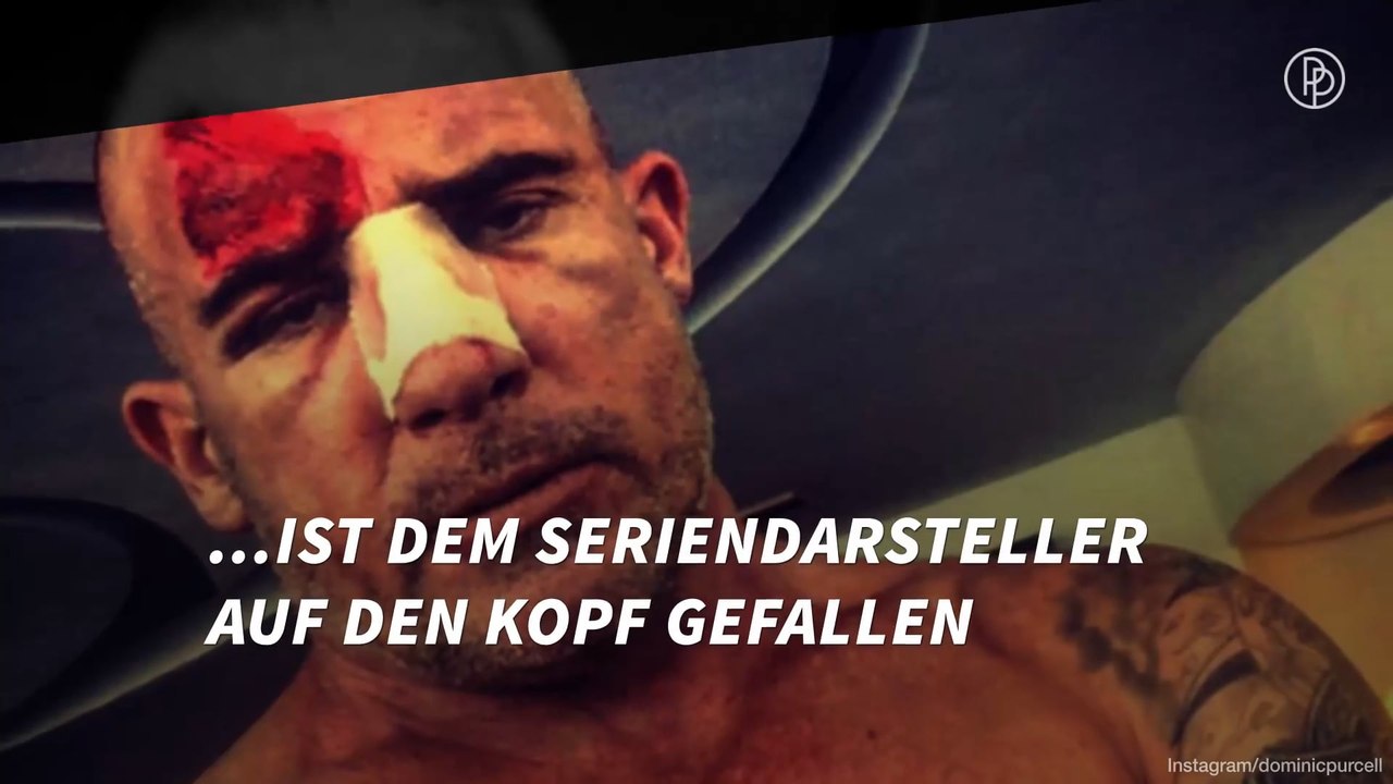 Stars, die sich am Set verletzten