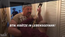 BTN: Krätze in Lebensgefahr