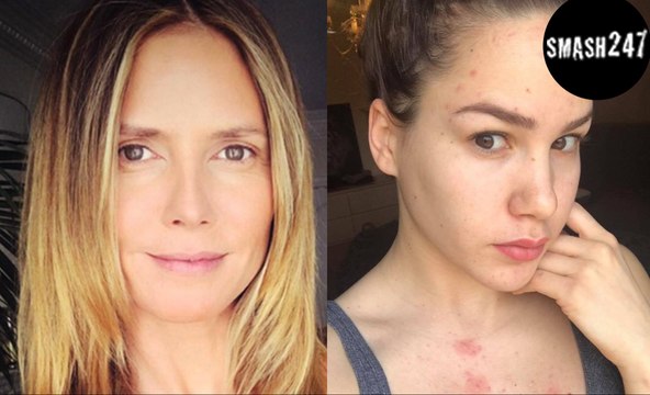 Angelina Heger & Heidi Klum: Wenn sich Promis ungeschminkt zeigen!