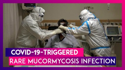 COVID-19-Triggered Rare Mucormycosis Infection: Half The Victims Lost Eyesight At Delhi Hospital