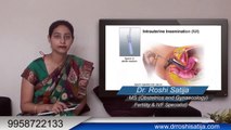 Intrauterine Insemination Fertility Treatment | IUI procedure step by step in Hindi