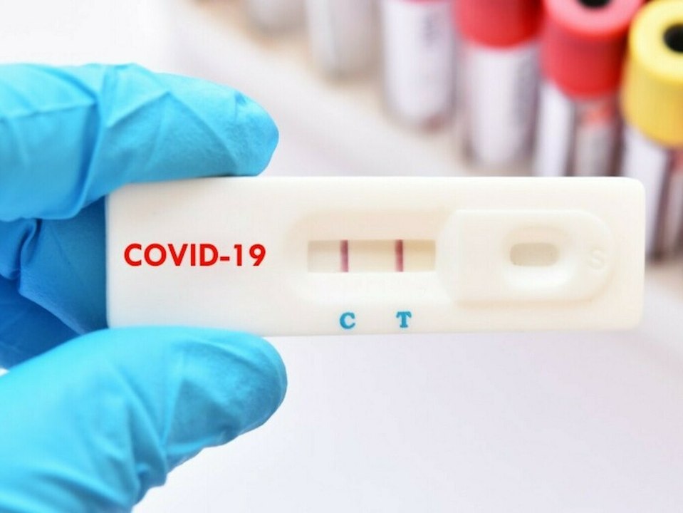 Illegal im Handel: Köln ruft Corona-Schnelltests zurück