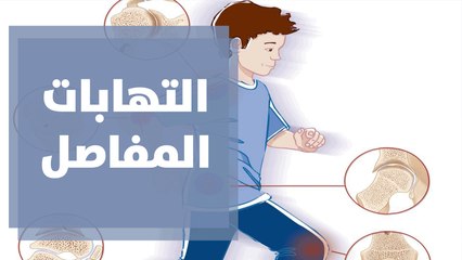 التهابات المفاصل..الأعراض والأسباب
