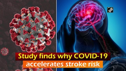 Study finds why Covid-19 accelerates stroke risk