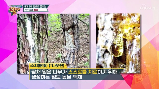 ❛○○❜으로 뇌 혈관 질환 정복하자✌️ #광고포함