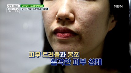 트러블에 홍조▶ 또래보다 빠른 피부 노화를 부른다? 〣(ºΔº)〣
