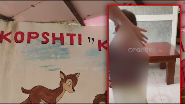 Ora News - Dhunimi i fëmijës në Durrës, gjyshja akuza ndaj kopshtit privat: Kishte shenja në fytyrë