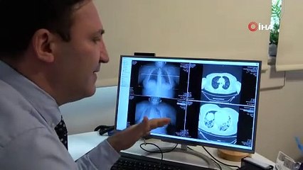 İlaç kullanan korona hastaları ile kullanmayanlar arasındaki inanılmaz fark