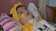 SMA hastası 17 aylık Yaren, tedavi için destek bekliyor