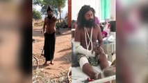 Aurangabad Sadhu Injured During An Attacked On Him