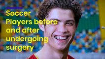 Soccer Players before and after undergoing surgery