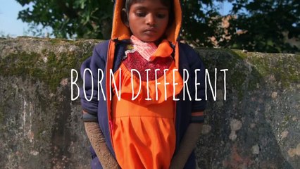 The Girl Who Is Turning To Stone - BORN DIFFERENT