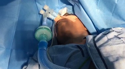 ब्रेन सर्जरी के वक्त गीता श्लोक बोलती रही महिला, जान बची, डॉक्टर बोले- ऐसा यह पहला ऑपरेशन VIDEO