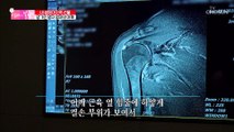 (걱정) 심각한 엄마의 어깨 상태.. 수술 후 상태는? TV CHOSUN 20210103 방송