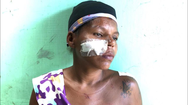 FILHA FALA SOBRE TENTATIVA DE FEMINICÍDIO DE SUA MÃE EM PEDRAS DE FOGO