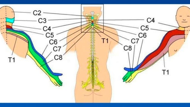 bd-relacion-entre-dolor-de-brazos-y-padecimientos-cervicales-040121