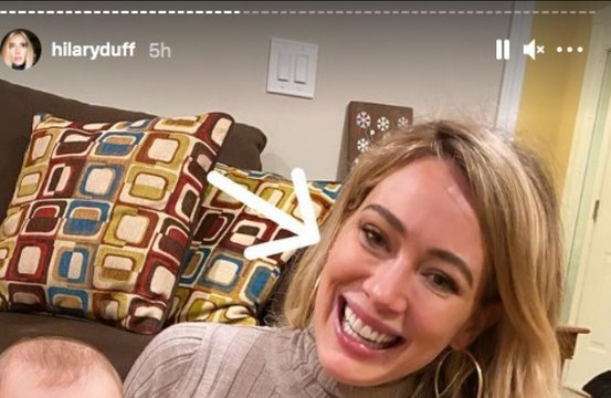 Hilary Duff got a painful eye infection from too many Covid-19 tests