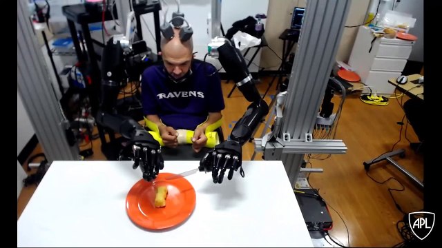 Il peut contrôler des bras robotisés avec son cerveau